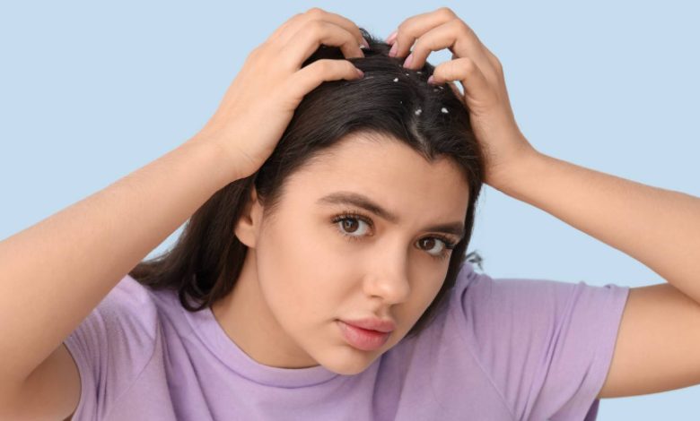 Zinc for dandruff: How to use it to deal with this scalp condition