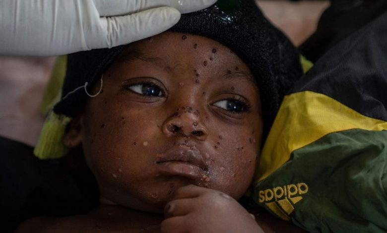 Mpox cases in Congo's epicentre may be 'plateauing,' WHO says