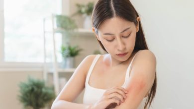 Caterpillar rash can cause skin irritation, know what to do about it