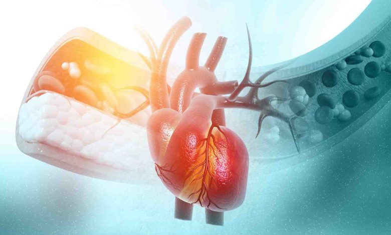 cholesterol levels