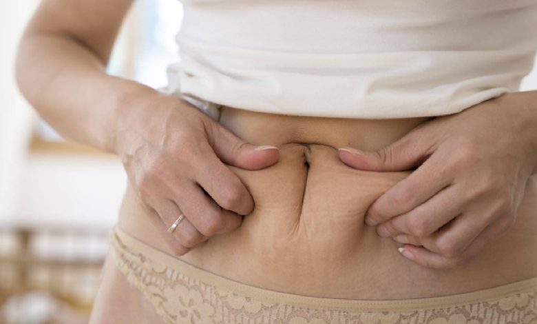 Menopause belly: What is it and how to deal with it