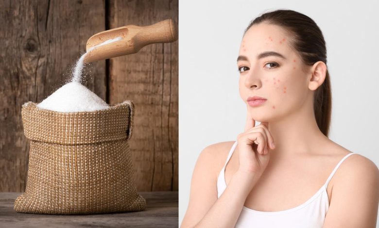 How does sugar affect your skin? 5 side effects of it