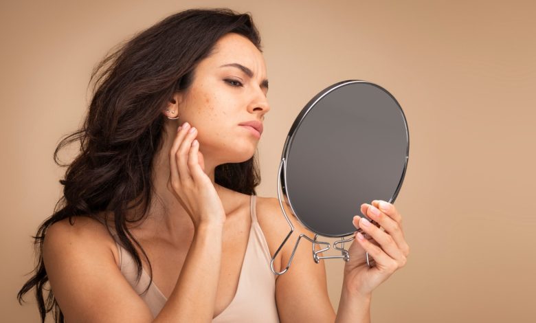 Hormonal acne diet: Foods to eat and avoid to manage breakouts