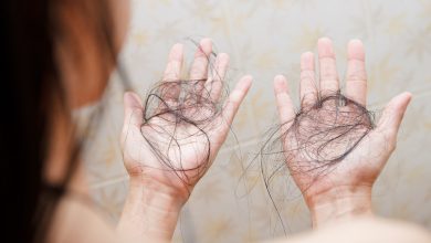 International Alopecia Day 2025: Cosmetic surgeon explains why autoimmune hair loss is rising