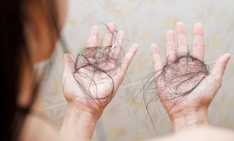 International Alopecia Day 2025: Cosmetic surgeon explains why autoimmune hair loss is rising